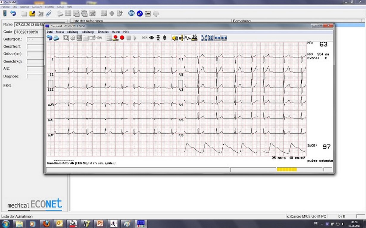 medical ECONET Cardio M-PC WiFi EKG System / 12-Kanal Ruhe-PC-EKG
