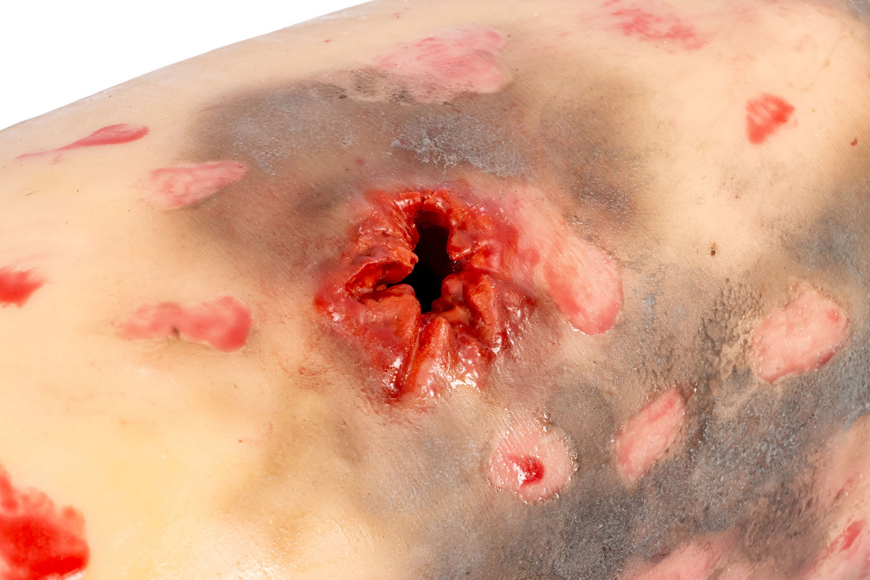 Erler Zimmer Trauma Torsten Beckenmodell zur Blutstillung und taktischen Traumaversorgung