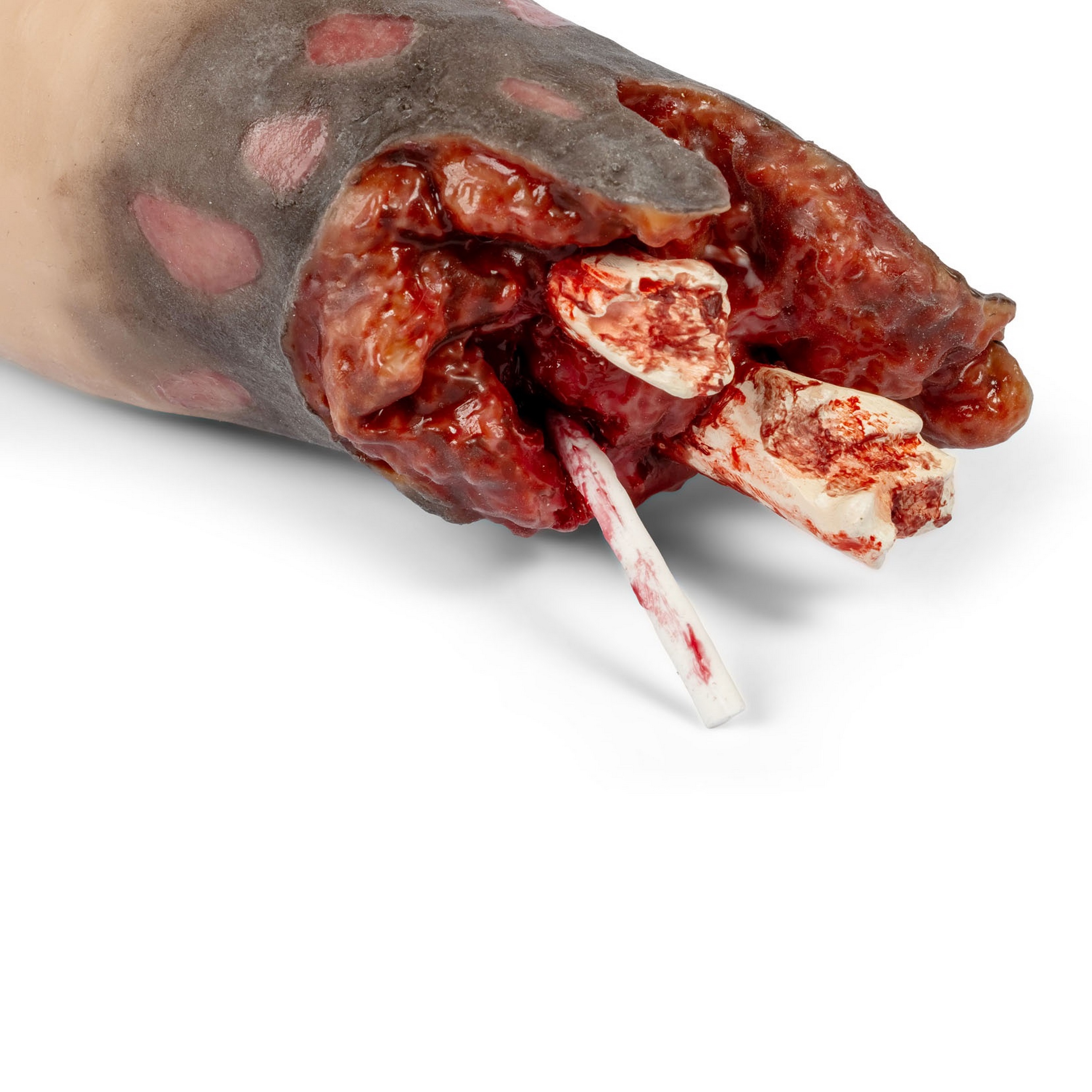 Erler Zimmer Amputationsstumpf Arm rechts für Combat Carl