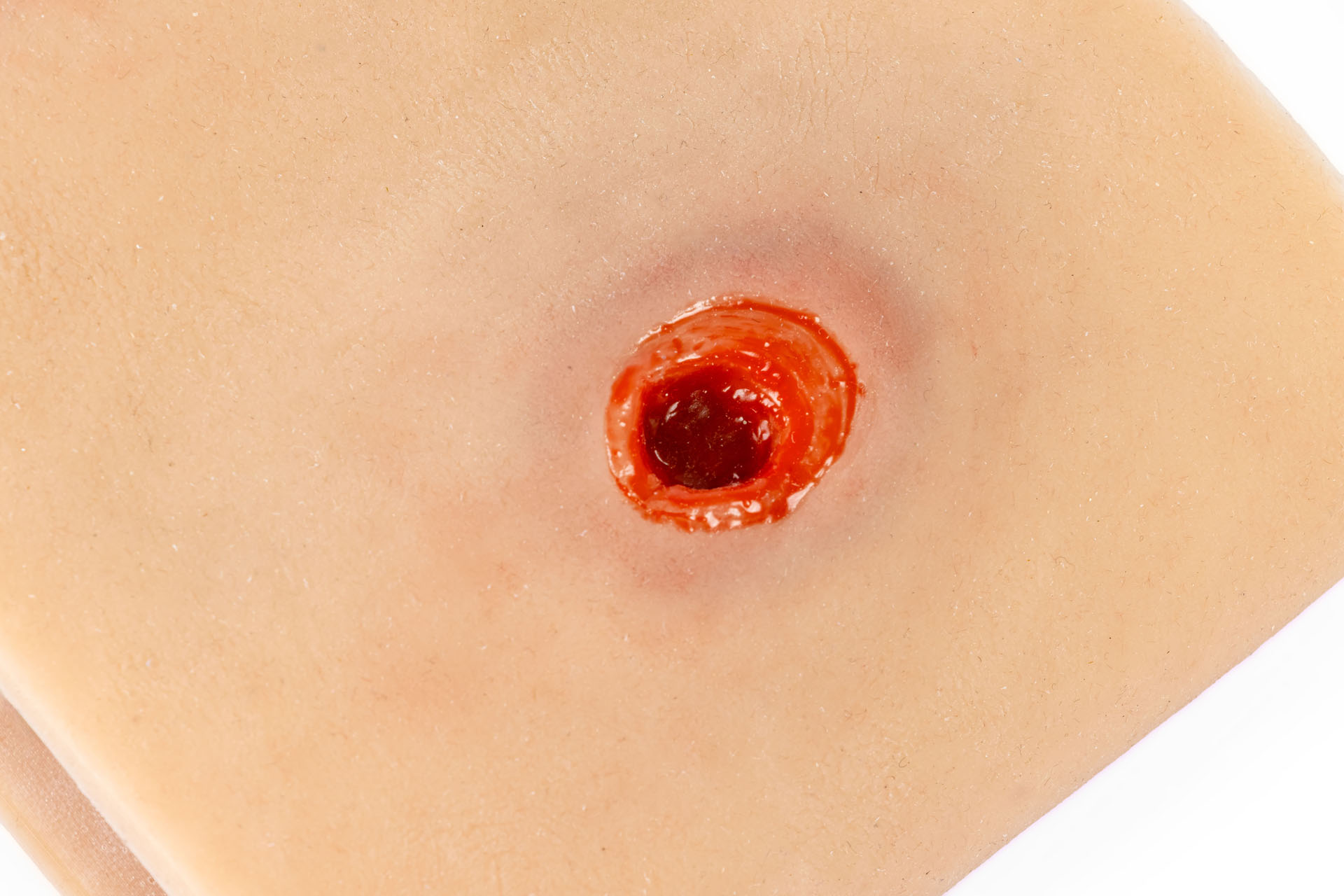 Erler Zimmer Wundmoulage Sleeve Schußwunde Arm mit Blutungsfunktion