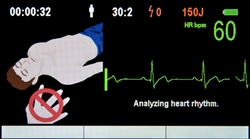 medical ECONET AED ME PAD Pro Defibrillator inklusive EKG Modul