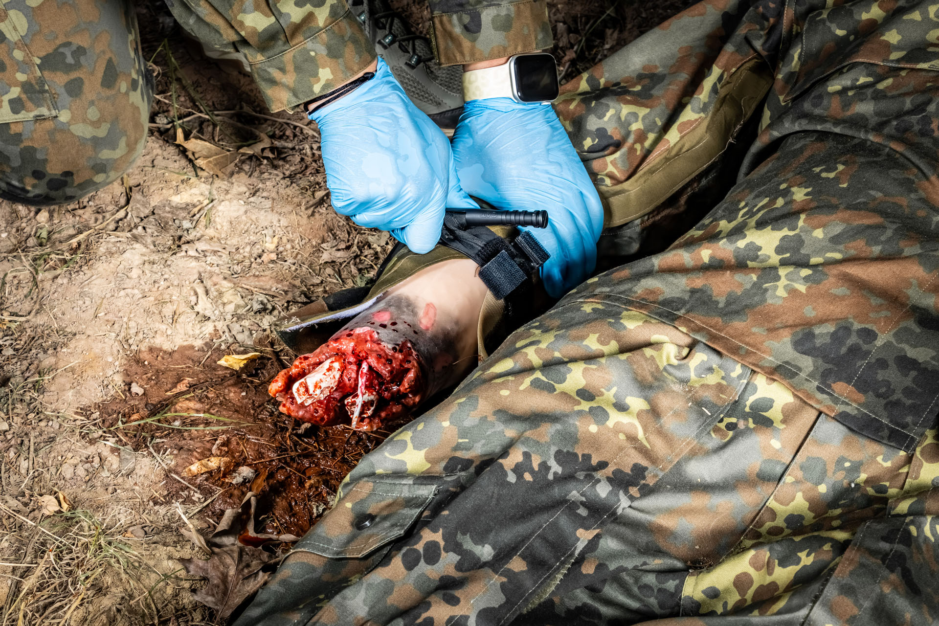 Erler Zimmer Amputationsstumpf Arm rechts für Combat Carl