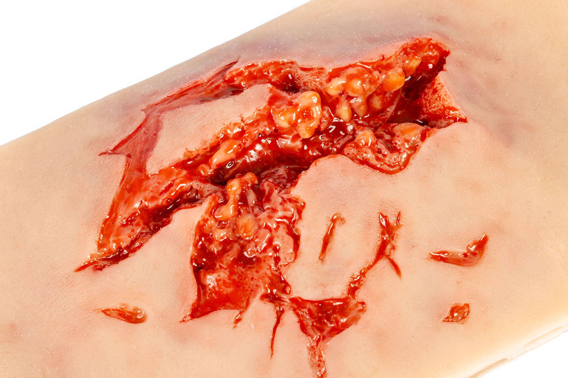 Erler Zimmer Wundmoulage Sleeve Riss Oberschenkel mit Blutungsfunktion