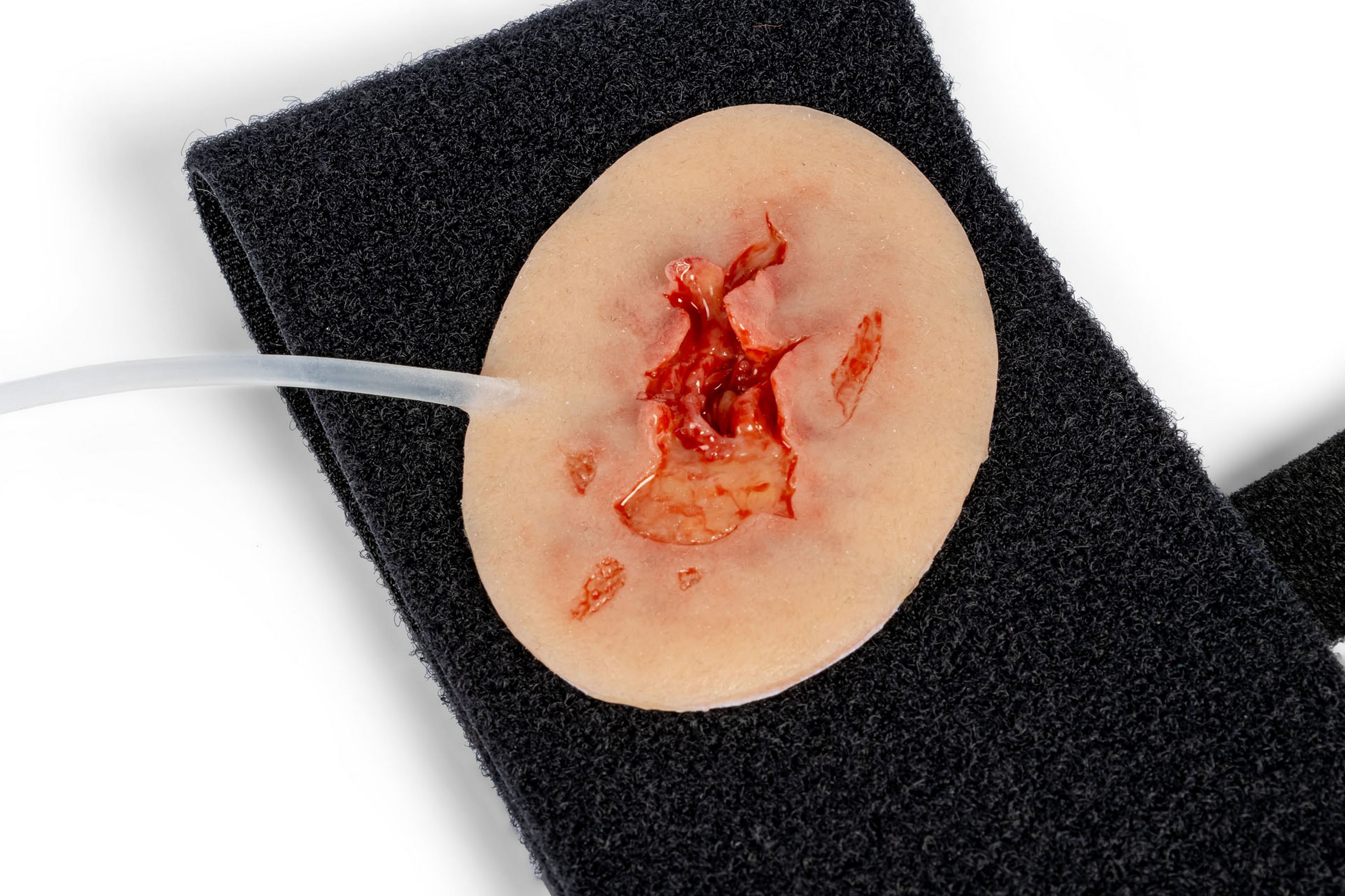 Erler Zimmer Wundmoulage Achselverletzung mit Blutungsfunktion