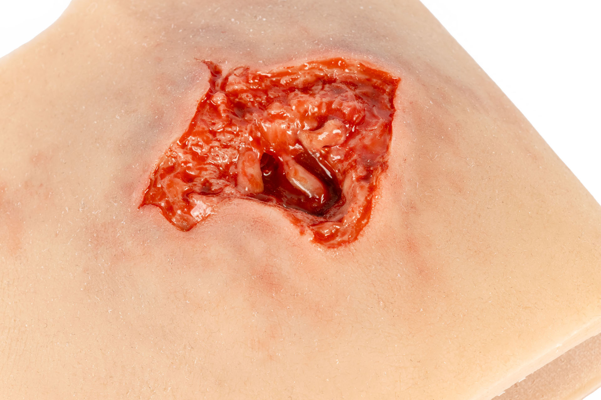 Erler Zimmer Wundmoulage Sleeve Schußwunde Arm mit Blutungsfunktion