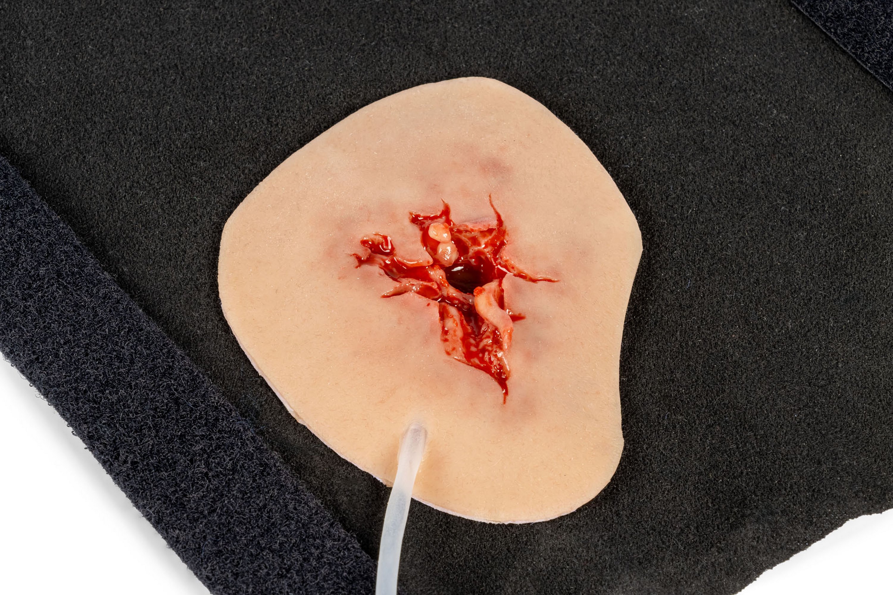 Erler Zimmer Wundmoulage Leistenverletzung mit Blutungsfunktion