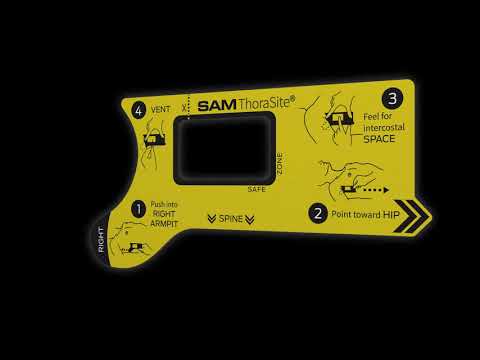 SAM® Medical ThoraSite® anatomische Orientierungshilfe | Packung á 1 Stück