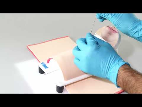 VBM® Surgicric III Chirurgisches Koniotomie Set | Seldinger Technik