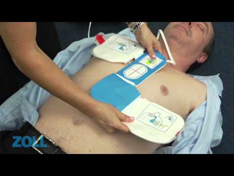 ZOLL® CPR Uni-padz™ Universal 3 Elektroden | Ausführung: Erwachsene / Kinder